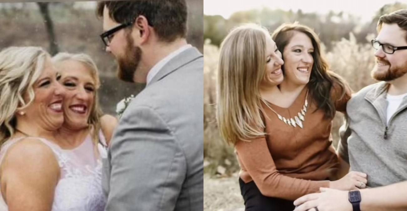 Abby και Brittany Hensel: Mία από τις πιο διάσημες σιαμαίες αδελφές των ΗΠΑ είναι πλέον παντρεμένη | CyprusNews.Live